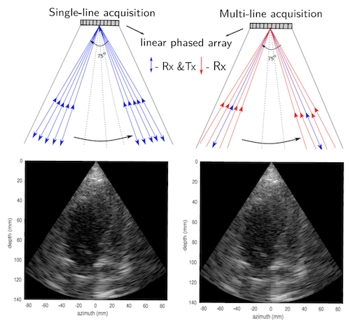 Picture for High frame-rate cardiac ultrasound imaging with deep learning