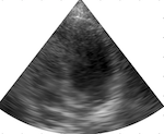 Picture for Learning beamforming in ultrasound imaging